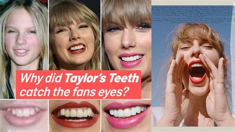 are taylor swift teeth fake